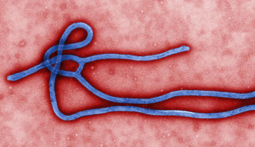 警惕最新病毒病人，你需要了解這些關(guān)鍵信息！