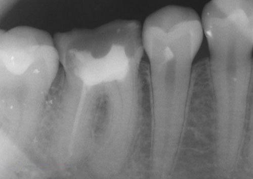 中國再生牙齒研究新進(jìn)展，重塑微笑，科技引領(lǐng)牙齒再生新篇章